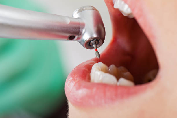 Best Emergency Tooth Extraction in Messiah College, PA